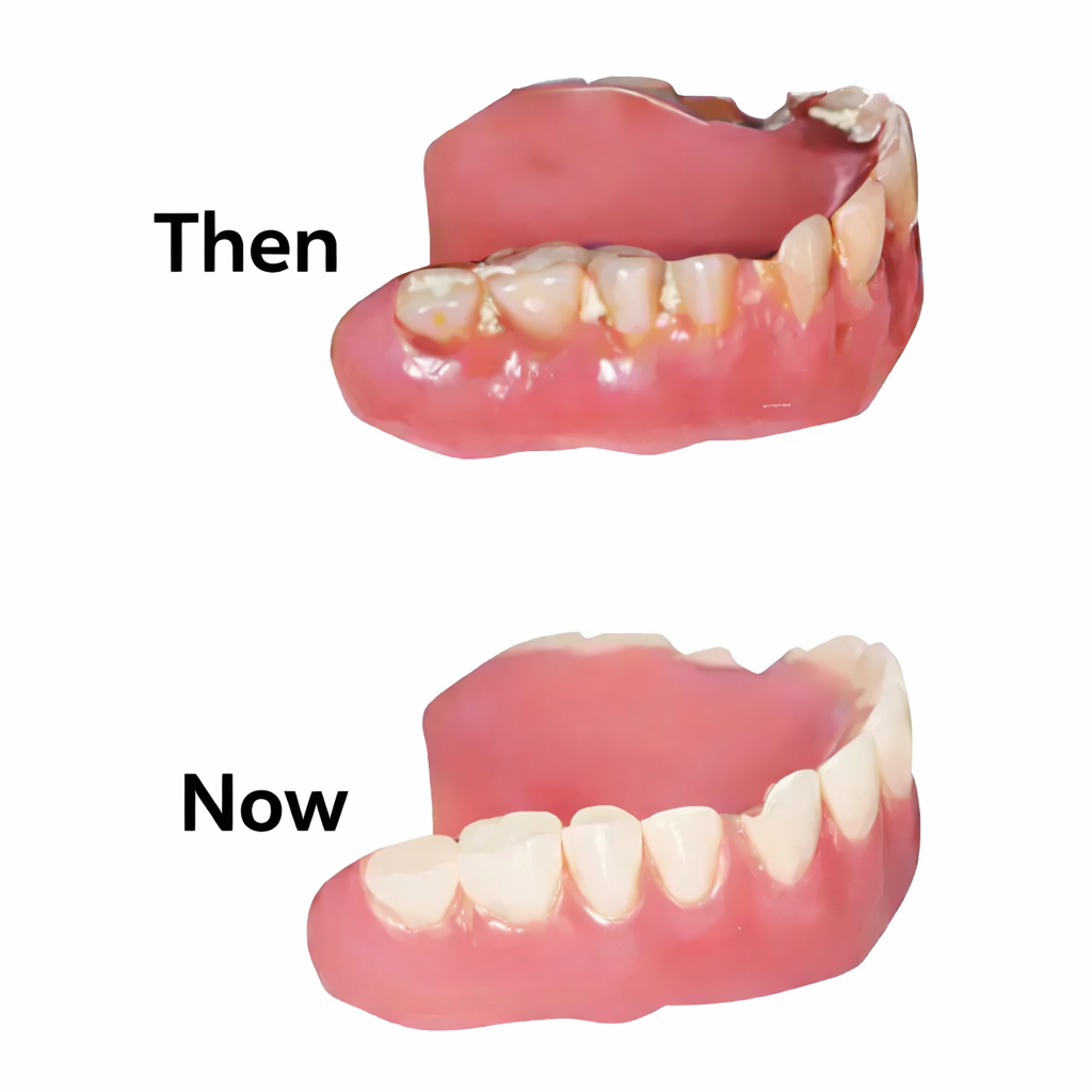 Denture Dome