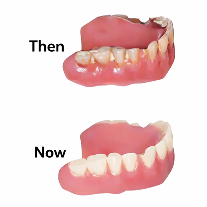 Denture Dome