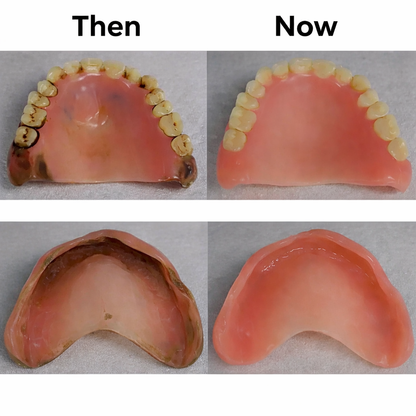 Denture Dome